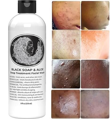 Natural Black Soap with Aloe – Helps with Bumps & Dark Spots for Face, Paraben Free, All Natural Liquid Soap, 2 Count Avelisse
