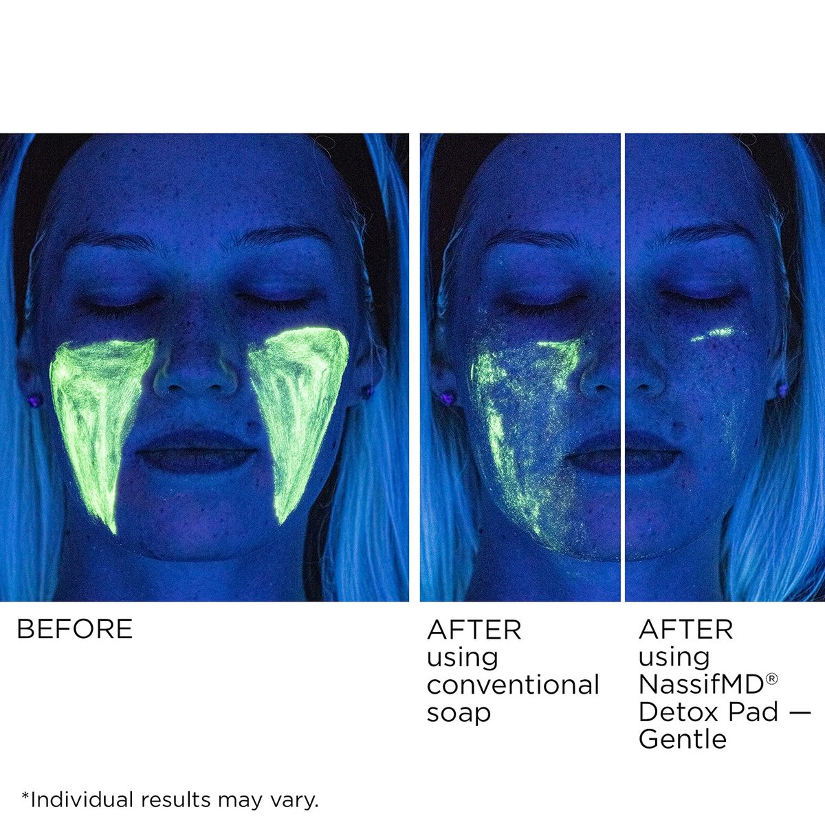 NassifMD Gentle Detox Pads – Surgeon-Created Fruit Acid Complex for Sensitive Skin, Brightens, Exfoliates & Reduces Wrinkles, 60 Count Avelisse