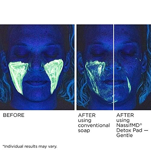 NassifMD Gentle Detox Pads – Surgeon-Created Fruit Acid Complex for Sensitive Skin, Brightens, Exfoliates & Reduces Wrinkles, 60 Count Avelisse
