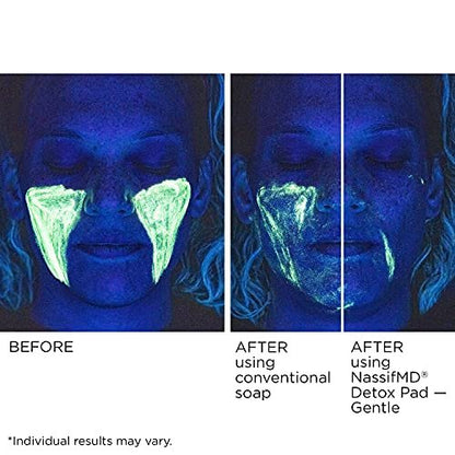 NassifMD Gentle Detox Pads – Surgeon-Created Fruit Acid Complex for Sensitive Skin, Brightens, Exfoliates & Reduces Wrinkles, 60 Count Avelisse