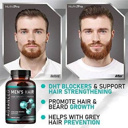 NutraPro Hair Growth Vitamins for Men – Anti Hair Loss Pills with Biotin & Saw Palmetto, Regrow Hair & Beard, Thicker, Fuller Hair, 120 Capsules Avelisse