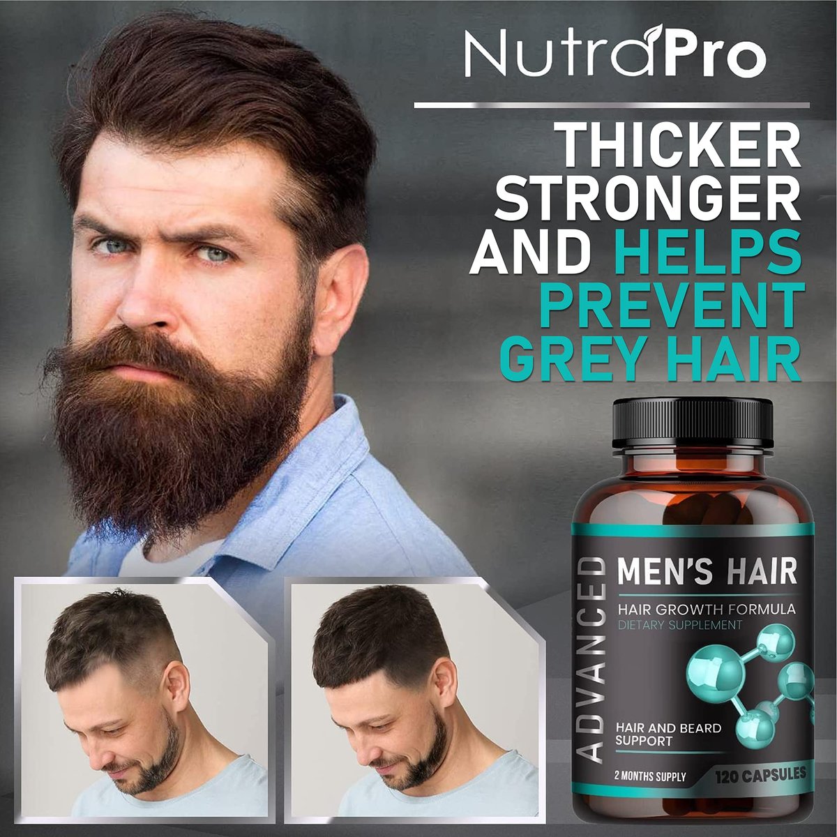 NutraPro Hair Growth Vitamins for Men – Anti Hair Loss Pills with Biotin & Saw Palmetto, Regrow Hair & Beard, Thicker, Fuller Hair, 120 Capsules Avelisse