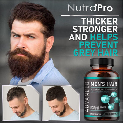 NutraPro Hair Growth Vitamins for Men – Anti Hair Loss Pills with Biotin & Saw Palmetto, Regrow Hair & Beard, Thicker, Fuller Hair, 120 Capsules Avelisse