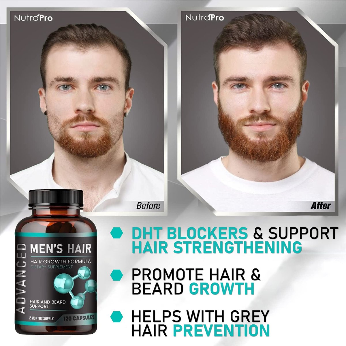 NutraPro Hair Growth Vitamins for Men – Anti Hair Loss Pills with Biotin & Saw Palmetto, Regrow Hair & Beard, Thicker, Fuller Hair, 120 Capsules Avelisse