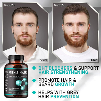 NutraPro Hair Growth Vitamins for Men – Anti Hair Loss Pills with Biotin & Saw Palmetto, Regrow Hair & Beard, Thicker, Fuller Hair, 120 Capsules Avelisse