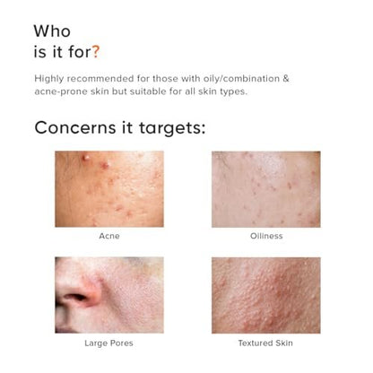 Minimalist 2% Salicylic Acid Face Wash for Oily, Acne Prone Skin | Anti Acne Face Wash With LHA & Zinc | Sulphate Free Gentle BHA Liquid Exfoliant | For Women & Men | 3.4 Fl Oz / 100 ml
