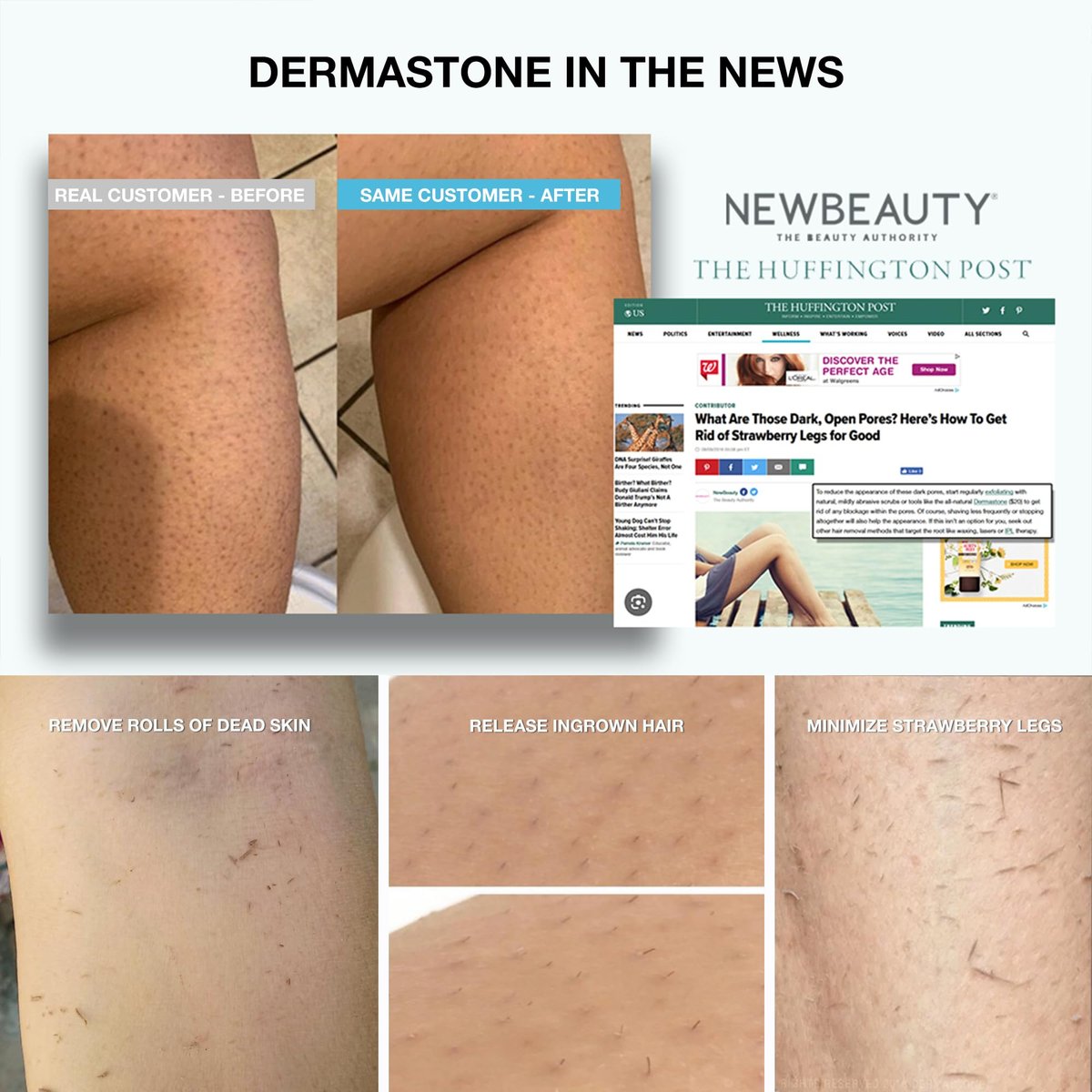 DERMASTONE LEG & BODY SCRUB - Deep Exfoliating Stone Body Scrubber for Strawberry Legs Treatment, Leg Exfoliator Ingrown Hair, Dead Skin Remover, Foot Scrub & Natural Body Exfoliator for Women Men Avelisse