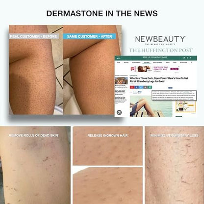 DERMASTONE LEG & BODY SCRUB - Deep Exfoliating Stone Body Scrubber for Strawberry Legs Treatment, Leg Exfoliator Ingrown Hair, Dead Skin Remover, Foot Scrub & Natural Body Exfoliator for Women Men Avelisse