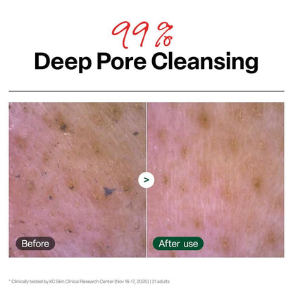 Dr.G pH Cleansing Gel Foam - Gentle Face Cleanser for All Skin Types, pH-Balanced, Hydrating, Deep Pore Cleansing, Korean Skincare, 6.76 fl oz Avelisse