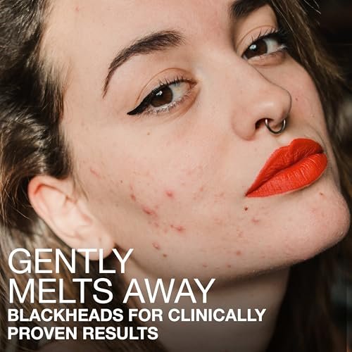 Neutrogena Stubborn Blackheads Daily Acne Facial Serum – Salicylic Acid, Glycolic Acid, Polyhydroxy & Mandelic Acids, Oil-Free, 1 fl. oz Avelisse