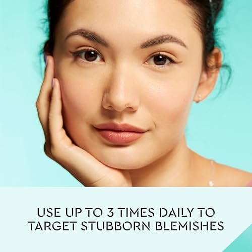 Bliss Clear Genius Acne Spot Treatment – Maximum Strength 2% Salicylic Acid, Shrinks Blemishes, Clean & Vegan, 0.5 Fl Oz Avelisse