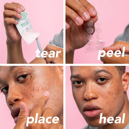 Mario Badescu Drying Patch Blemish Covering - Invisible Spot Treatment with Vitamin C, Vegan & Cruelty Free, Strong Hold (60 Patches, 12mm), Clear Avelisse