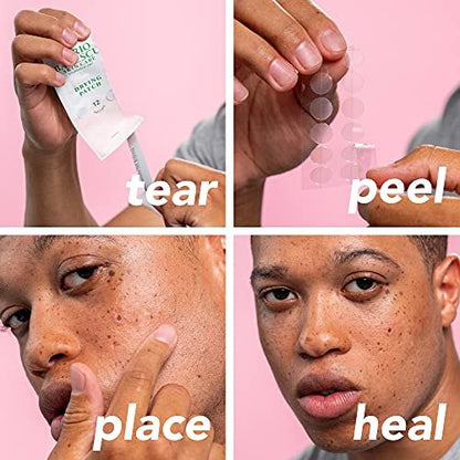 Mario Badescu Drying Patch Blemish Covering - Invisible Spot Treatment with Vitamin C, Vegan & Cruelty Free, Strong Hold (60 Patches, 12mm), Clear Avelisse