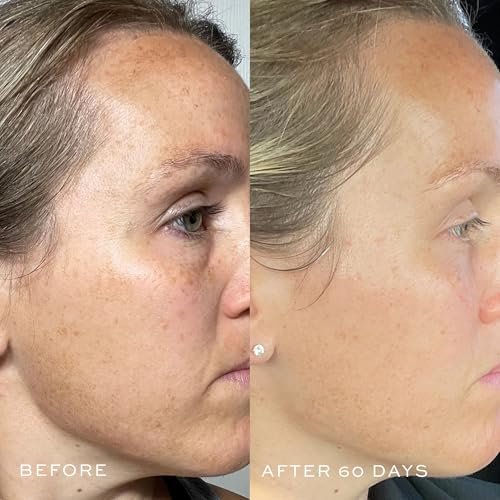 DIME Beauty TBT Serum - Anti-Aging Face Serum with Bakuchiol, Niacinamide and Mandelic Acid, Retinol Alternative for Fine Lines and Wrinkles, Vegan, Cruelty-Free, 1 oz / 30 ml Avelisse