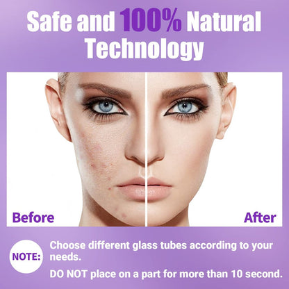 UUPAS Portable High Frequency Facial Wand with 4 Violet Glass Tubes – Skin Rejuvenation & Acne Treatment Avelisse