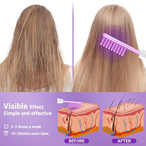 UUPAS Portable High Frequency Facial Wand with 4 Violet Glass Tubes – Skin Rejuvenation & Acne Treatment Avelisse