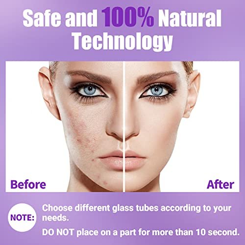 UUPAS Portable High Frequency Facial Wand with 4 Violet Glass Tubes – Skin Rejuvenation & Acne Treatment Avelisse