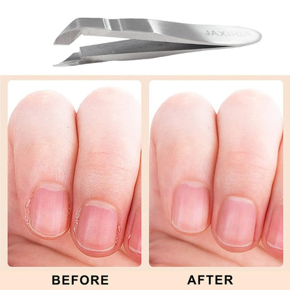 Mini Nail Cuticle Trimmer Kit – Stainless Steel Cuticle Nipper, Cutter, Pusher & Scraper for Hangnails (1 Pack)