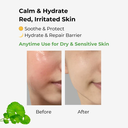 BMBCO The Cica Serum – Calming & Balancing Ampoule for Sensitive Skin | Vegan Korean Skincare with Tiger Grass – 30ml/1.01 fl oz