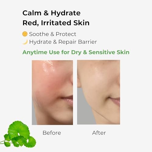 BMBCO The Cica Serum – Calming & Balancing Ampoule for Sensitive Skin | Vegan Korean Skincare with Tiger Grass – 30ml/1.01 fl oz - görsel 6