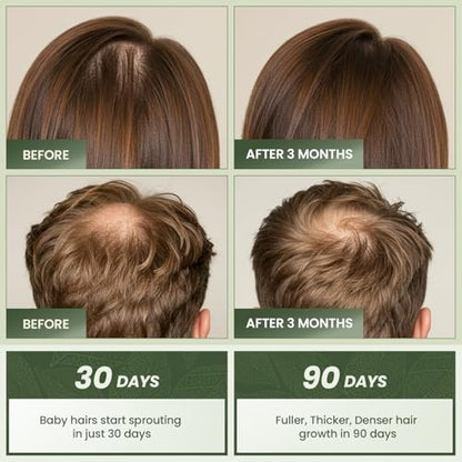 Essynaturals Hair Growth Oil with Biotin - Caffeine and Castor Oil for Fuller, Thicker, Longer Hair Avelisse