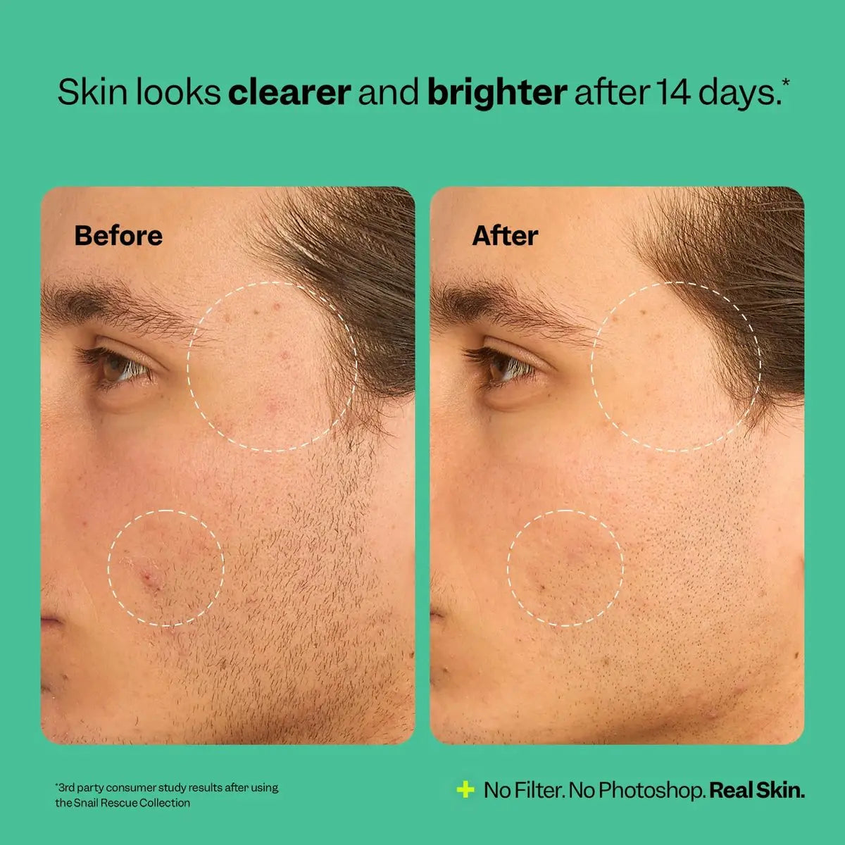 Peach Slices Snail Rescue Blemish Busting Toner - 95% Snail Mucin with Hyaluronic Acid & CICA - Clarify, Strengthen & Balance - 4.05 oz Avelisse