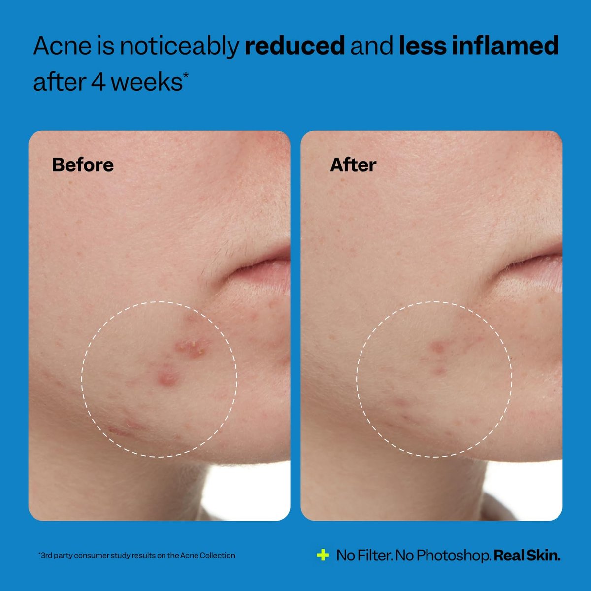 Peach Slices Acne Exfoliating Toner - 2% Salicylic Acid with Lactic & Glycolic Acid, Cucumber - Vegan & Cruelty-Free Korean Skincare (4.05 oz) - görsel 11