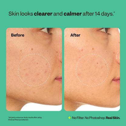 Peach Slices Snail Rescue Intensive Wash-Off Jelly Mask - 95% Snail Mucin Concentrate for Clear, Gentle Skin