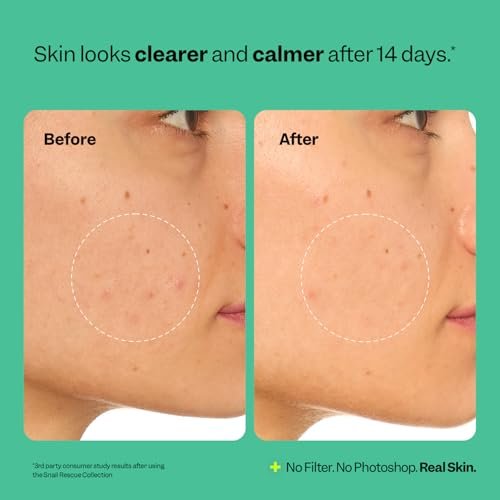 Peach Slices Snail Rescue Intensive Wash-Off Jelly Mask - 95% Snail Mucin Concentrate for Clear, Gentle Skin - görsel 12