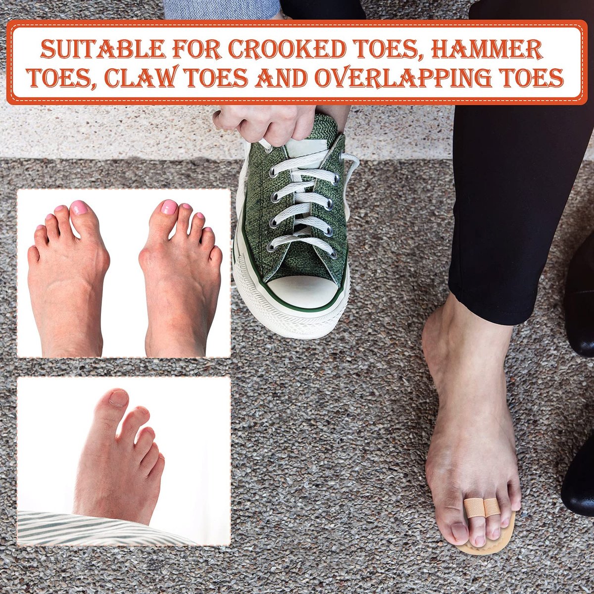 Nuanchu 6-Piece Double Toe Straightener & Hammer Toe Splint Corrector for Foot Pain Relief - görsel 9