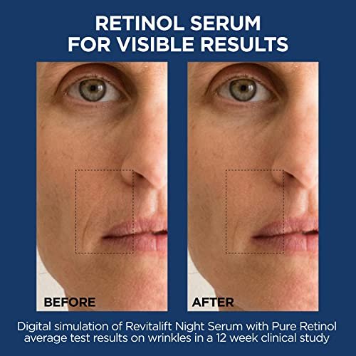 L'Oreal Paris Revitalift 1.5% Pure Hyaluronic Acid Face Serum + 0.3% Pure Retinol Night Serum, 1 kit Avelisse