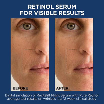 L'Oreal Paris Revitalift 1.5% Pure Hyaluronic Acid Face Serum + 0.3% Pure Retinol Night Serum, 1 kit Avelisse