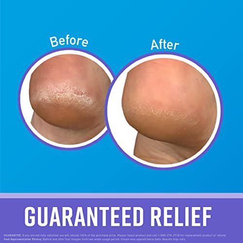 O'Keeffe's Working Hands Night Treatment Hand Cream & Healthy Feet Night Treatment Foot Cream, 7 oz Tubes (Pack of 2) Avelisse
