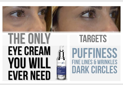 Dermlogic Under Eye Puffiness & Dark Circles Rapid Treatment - Instantly Reduces Puffy Eye Bags, Crow's Feet & Sagging Skin - 0.5 oz Avelisse
