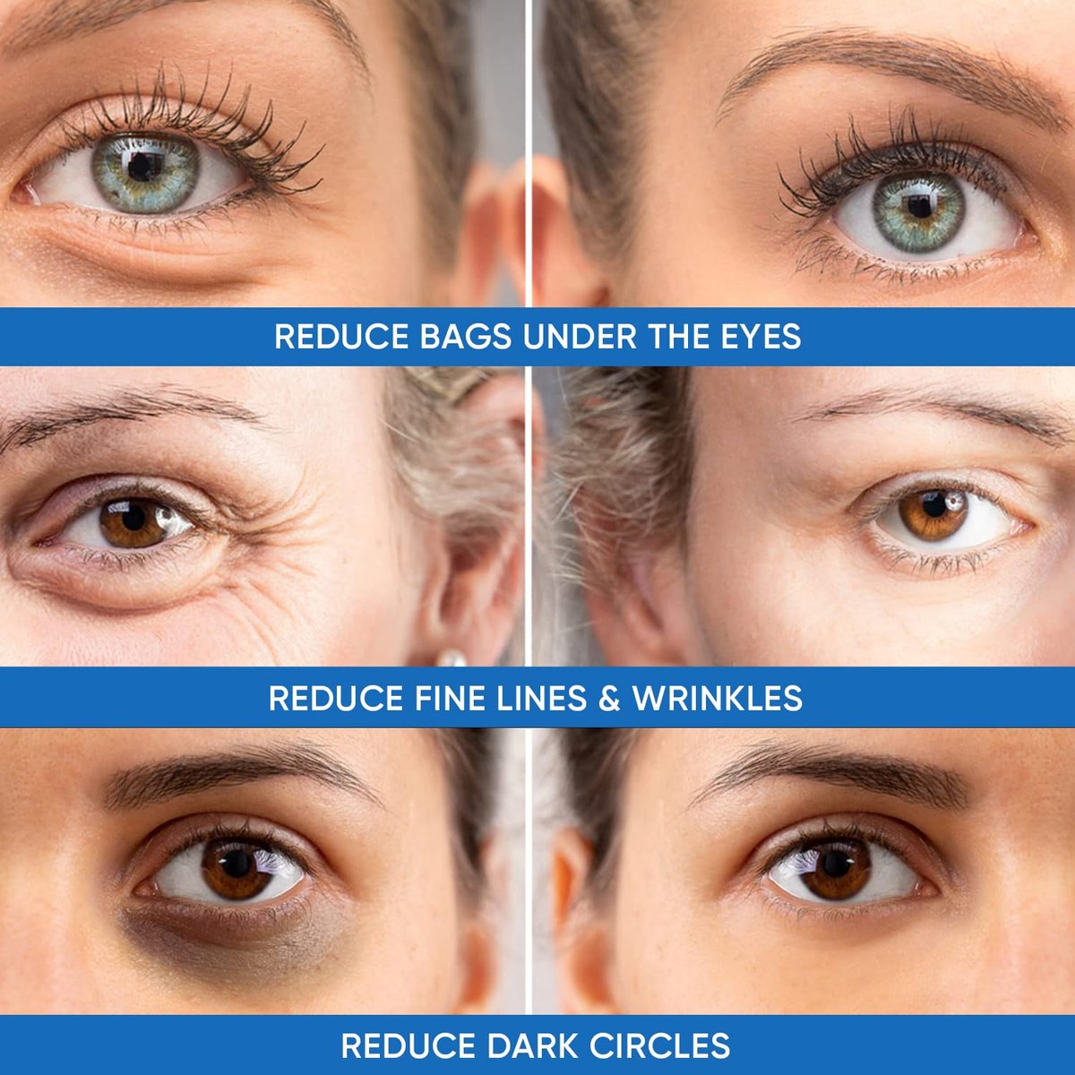 Dermlogic Under Eye Puffiness & Dark Circles Rapid Treatment - Instantly Reduces Puffy Eye Bags, Crow's Feet & Sagging Skin - 0.5 oz Avelisse
