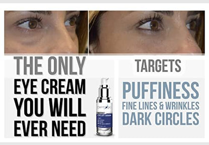 Dermlogic Under Eye Puffiness & Dark Circles Rapid Treatment - Instantly Reduces Puffy Eye Bags, Crow's Feet & Sagging Skin - 0.5 oz Avelisse