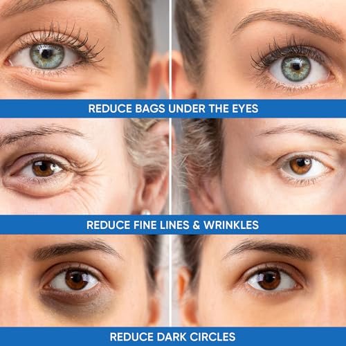 Dermlogic Under Eye Puffiness & Dark Circles Rapid Treatment - Instantly Reduces Puffy Eye Bags, Crow's Feet & Sagging Skin - 0.5 oz Avelisse