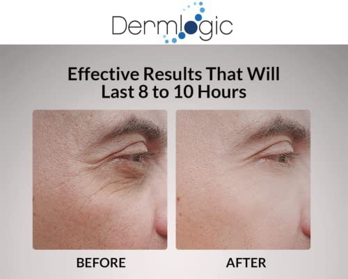 Dermlogic Under Eye Puffiness & Dark Circles Rapid Treatment - Instantly Reduces Puffy Eye Bags, Crow's Feet & Sagging Skin - 0.5 oz Avelisse