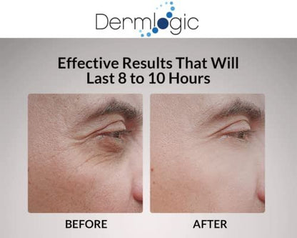 Dermlogic Under Eye Puffiness & Dark Circles Rapid Treatment - Instantly Reduces Puffy Eye Bags, Crow's Feet & Sagging Skin - 0.5 oz Avelisse