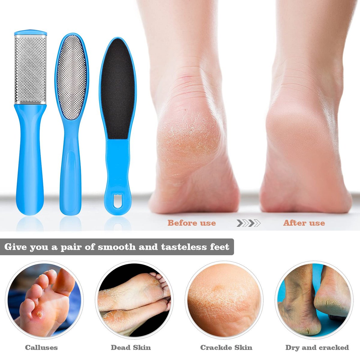 23-in-1 Professional Pedicure Kit with Stainless Steel Callus Remover & Foot File - Home Foot Spa for Men & Women (Blue) - görsel 9