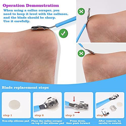 23-in-1 Professional Pedicure Kit with Stainless Steel Callus Remover & Foot File - Home Foot Spa for Men & Women (Blue)