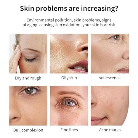 HKH Retinol Serum Capsules for Face - Anti-Aging Wrinkle Skincare with Vitamin A, E & Collagen - Moisturizing, Smoothing Fine Lines & Firming Skin - Travel Friendly (38 Capsules) Avelisse