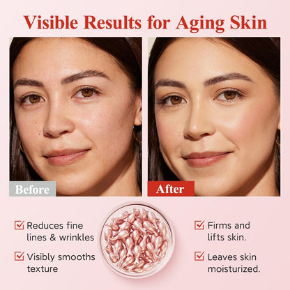 HKH Retinol Serum Capsules for Face - Anti-Aging Wrinkle Skincare with Vitamin A, E & Collagen - Moisturizing, Smoothing Fine Lines & Firming Skin - Travel Friendly (38 Capsules) Avelisse