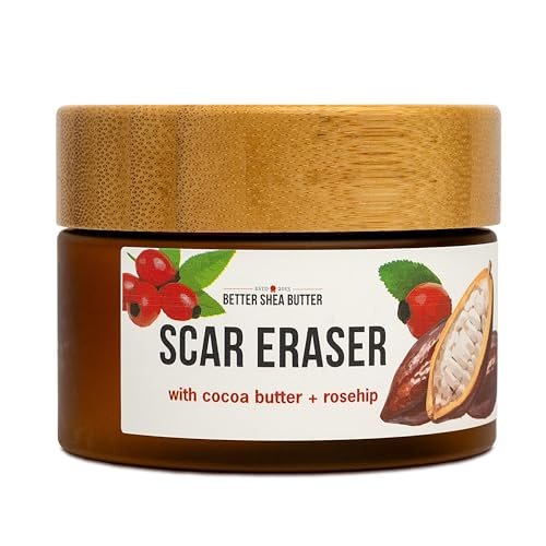 Better Shea Butter Scar Eraser Balm - Cocoa Butter Cream for Stretch Marks, Dark Spots, Burns & Old Scars - Zero Synthetic Ingredients, 4 oz Avelisse