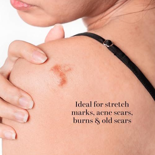 Better Shea Butter Scar Eraser Balm - Cocoa Butter Cream for Stretch Marks, Dark Spots, Burns & Old Scars - Zero Synthetic Ingredients, 4 oz Avelisse