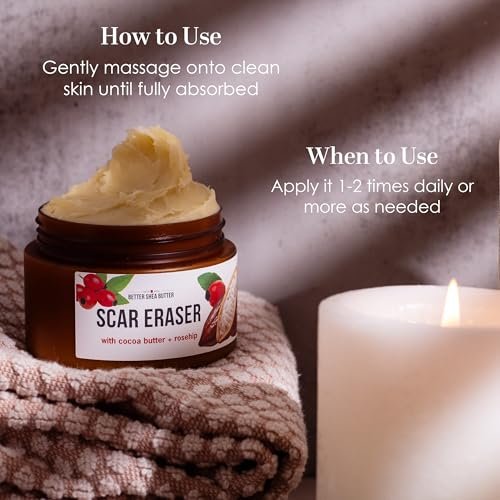 Better Shea Butter Scar Eraser Balm - Cocoa Butter Cream for Stretch Marks, Dark Spots, Burns & Old Scars - Zero Synthetic Ingredients, 4 oz Avelisse