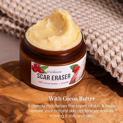 Better Shea Butter Scar Eraser Balm - Cocoa Butter Cream for Stretch Marks, Dark Spots, Burns & Old Scars - Zero Synthetic Ingredients, 4 oz Avelisse