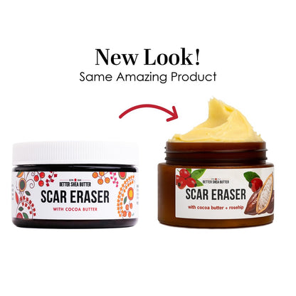 Better Shea Butter Scar Eraser Balm - Cocoa Butter Cream for Stretch Marks, Dark Spots, Burns & Old Scars - Zero Synthetic Ingredients, 4 oz Avelisse
