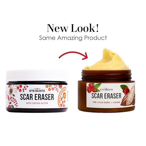 Better Shea Butter Scar Eraser Balm - Cocoa Butter Cream for Stretch Marks, Dark Spots, Burns & Old Scars - Zero Synthetic Ingredients, 4 oz Avelisse