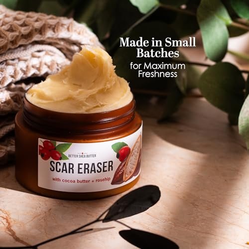 Better Shea Butter Scar Eraser Balm - Cocoa Butter Cream for Stretch Marks, Dark Spots, Burns & Old Scars - Zero Synthetic Ingredients, 4 oz Avelisse